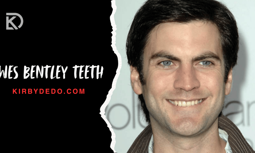 wes bentley teeth